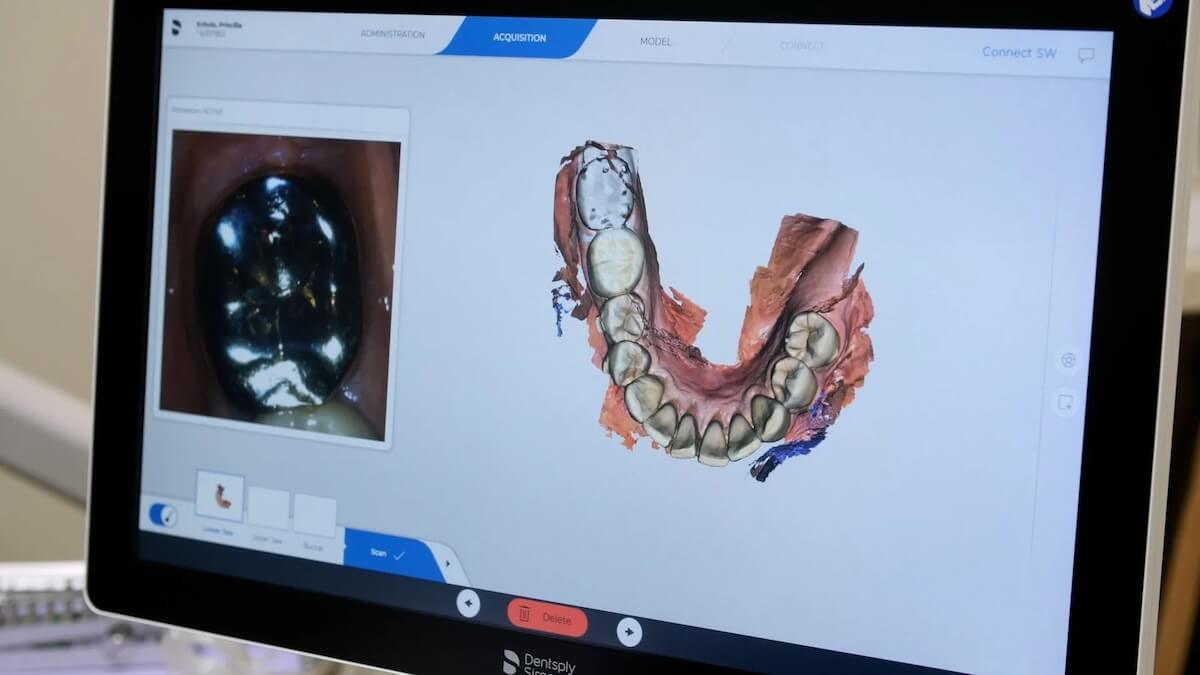 Intraoral Camera in Surprise, AZ