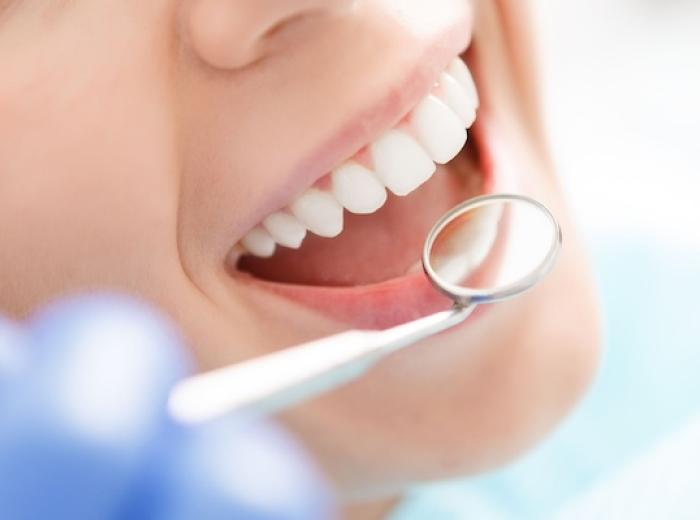 How Plaque and Tartar Affect Your Oral Health