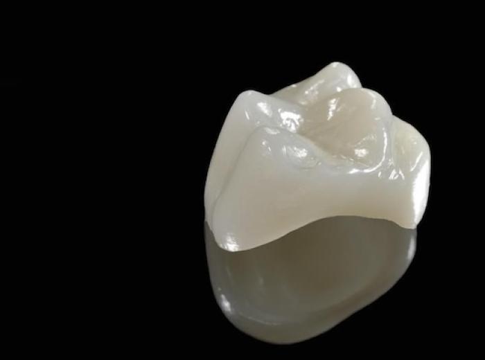 How to Know When You Need a Dental Crown