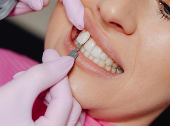 Latest Trends in Cosmetic Dentistry