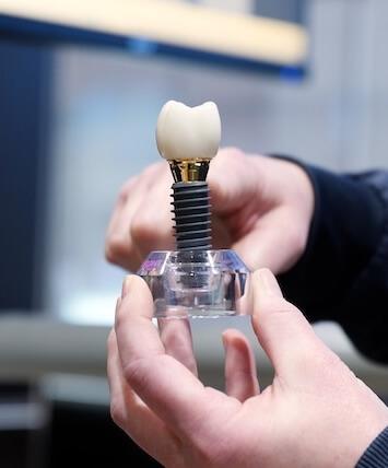 Dental Implants